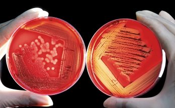 La resistencia bacteriana a los antibióticos: un desafío creciente en la medicina moderna